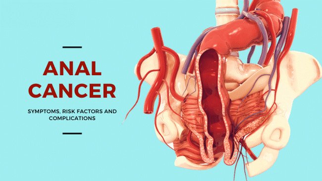 analcancer_symptoms_treatment_Texas.jpg