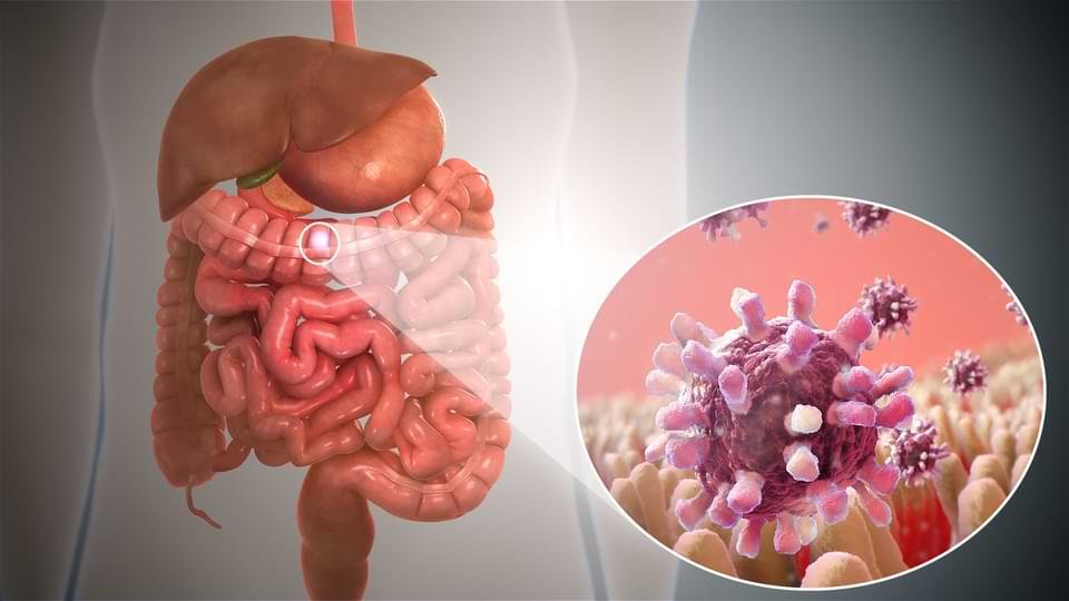 Silent Signs of GI Cancer: Symptoms You Shouldn't Ignore
