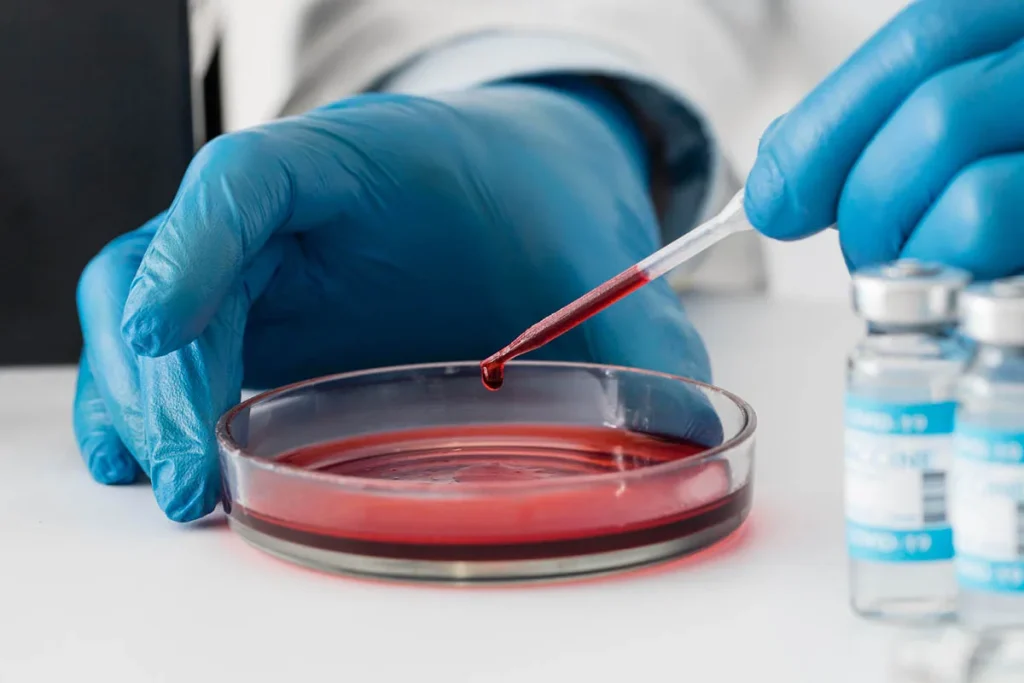stem-cell-therapy.webp