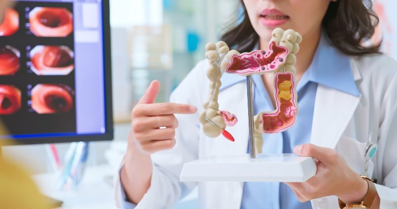 colorectal-cancer-importance.jpg