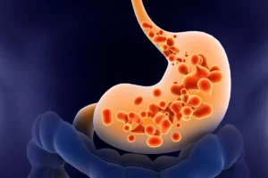 Why You Shouldn’t Ignore Persistent Acid Reflux: A Sign of Oesophageal Cancer?