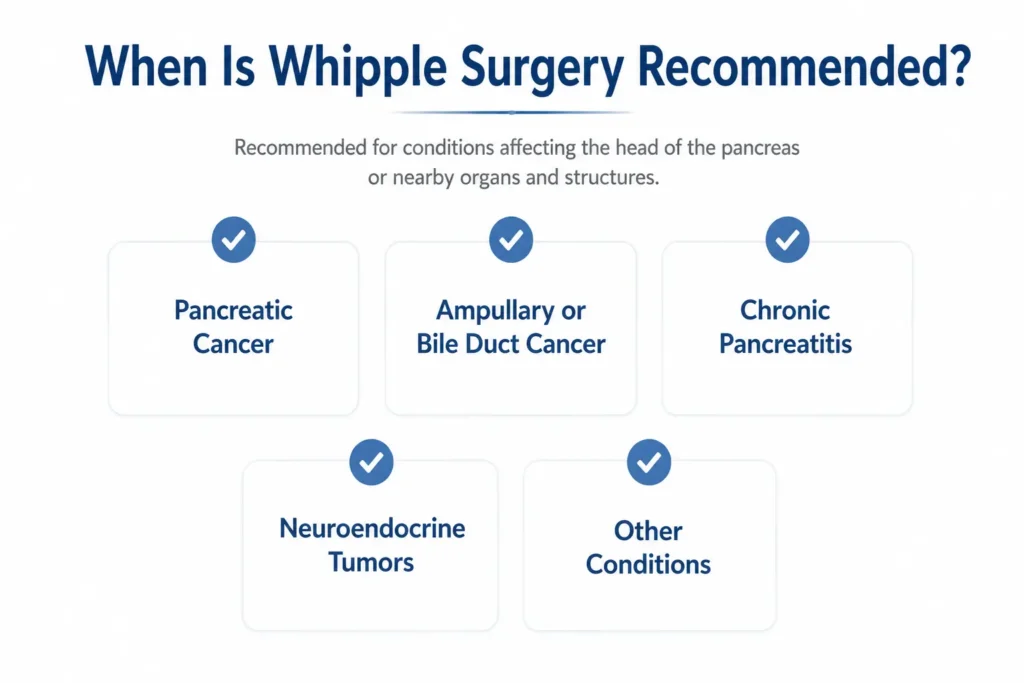 Infographic on When is whipple surgery recommendedWhipple procedure in Delhi Whipple surgery in Delhi Whipple surgeon in Delhi Whipple surgery Delhi NCR pancreatic cancer surgery in Delhi pancreatic cancer surgeon in Delhi pancreatic surgeon in Delhi pancreaticoduodenectomy in Delhi Whipple surgery cost in Delhi robotic Whipple surgery in Delhi