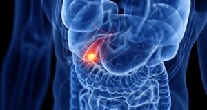 What You Need To Know About Gallbladder Cancer Surgery Options?