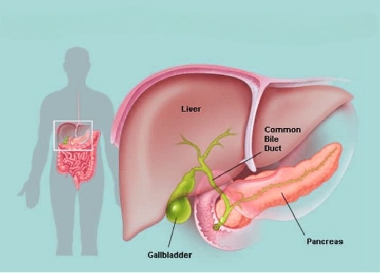 Is Gallbladder Cancer Curable?