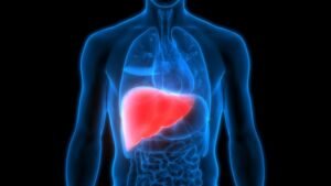 Is Fatty Liver Disease Linked to Liver Cancer Risk?