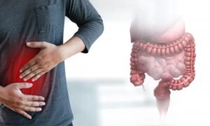 What Should You Eat Post-Colorectal Surgery?