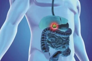 What Surgeries Are Common For Bile Duct Cancer?