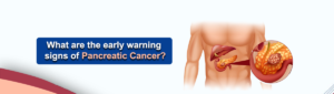 What Are the Early Signs of Pancreatic Cancer?