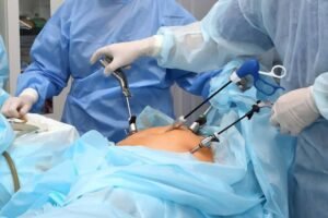 लेप्रोस्कोपिक सर्जरी (Laparoscopic Surgery) क्या है? फायदे, प्रक्रिया, खर्च और रिकवरी की पूरी जानकारी