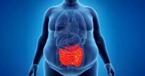 Obesity and Gastrointestinal Cancers: Know the Risks
