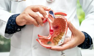 How to Prevent Stomach Cancer from Coming Back?