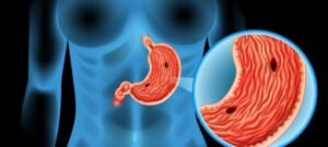 Top 10 Possible Warning Signs of Stomach Cancer: Don’t Ignore These