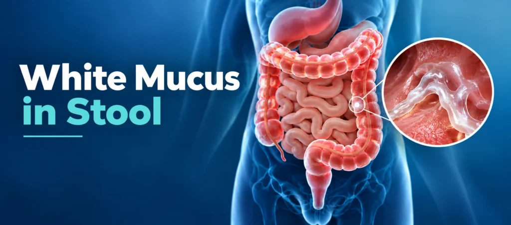 White Mucus in Stool: Causes, What It Means & When to See a Doctor